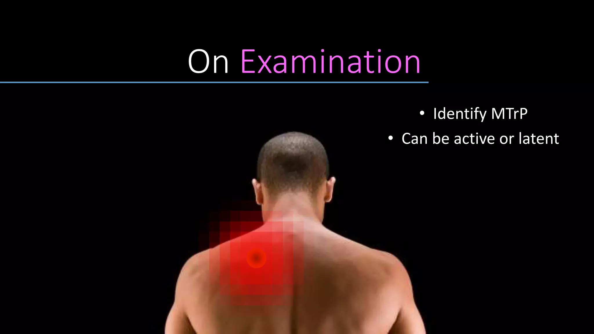 On Examination
• Identify MTrP
• Can be active or latent
 