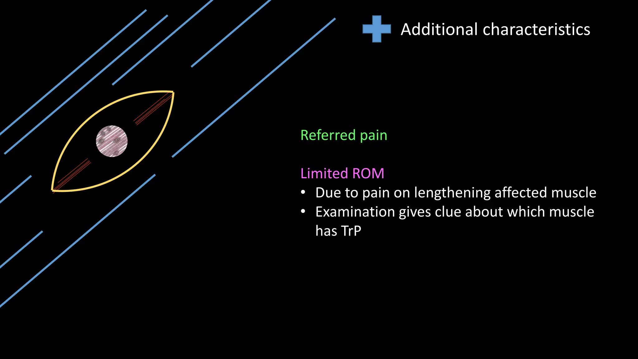 Additional characteristics
Referred pain
Limited ROM
• Due to pain on lengthening affected muscle
• Examination gives clue about which muscle
has TrP
 