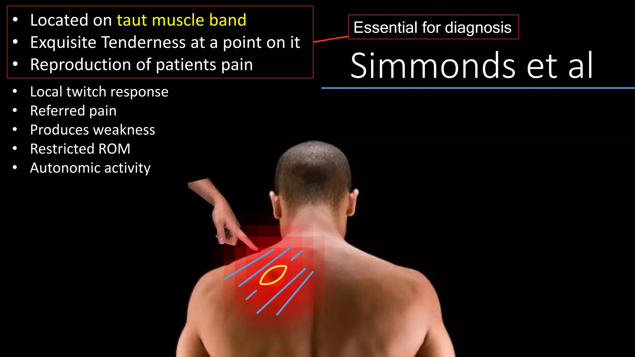 • Located on taut muscle band
• Exquisite Tenderness at a point on it
• Reproduction of patients pain
• Local twitch response
• Referred pain
• Produces weakness
• Restricted ROM
• Autonomic activity
Essential for diagnosis
Simmonds et al
 