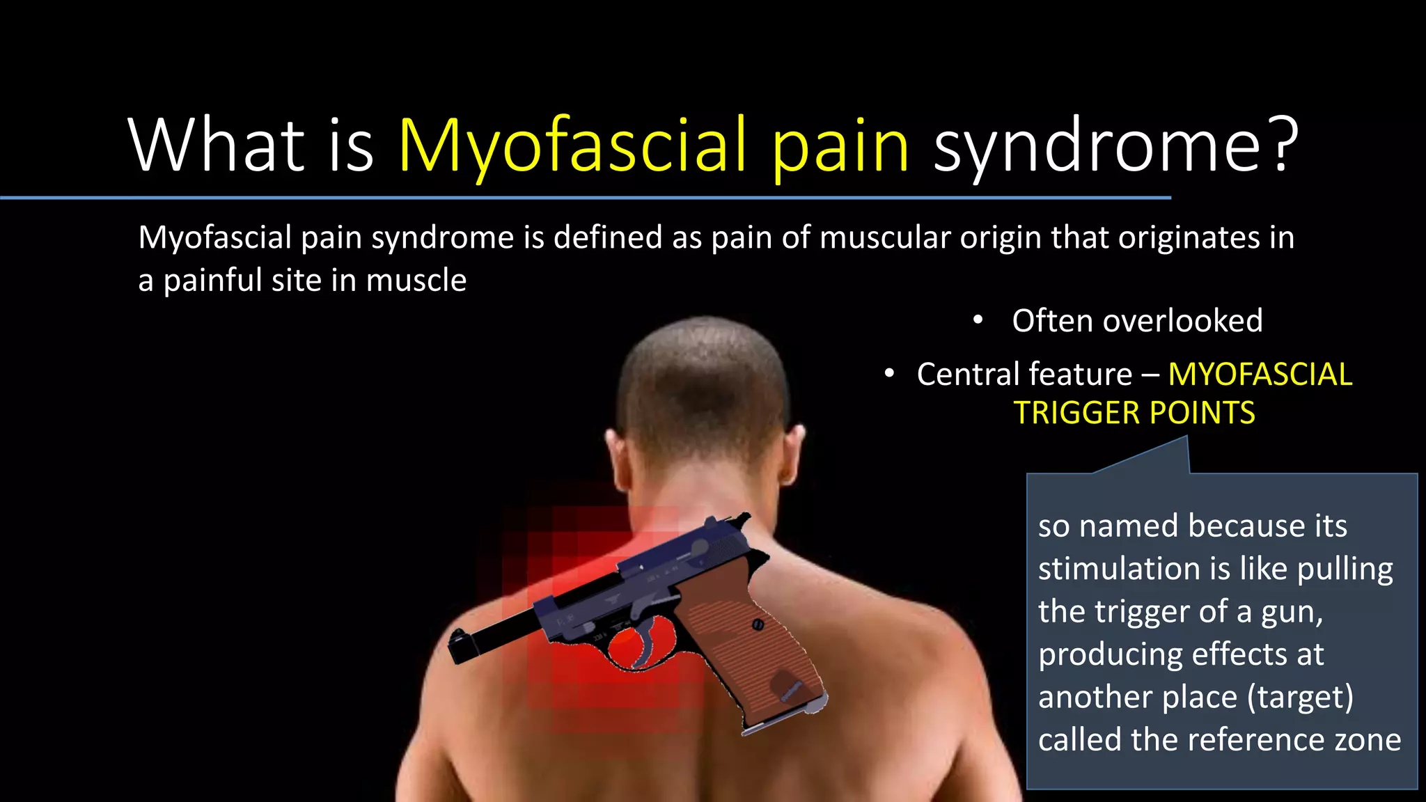 What is Myofascial pain syndrome?
• Often overlooked
• Central feature – MYOFASCIAL
TRIGGER POINTS
so named because its
stimulation is like pulling
the trigger of a gun,
producing effects at
another place (target)
called the reference zone
Myofascial pain syndrome is defined as pain of muscular origin that originates in
a painful site in muscle
 