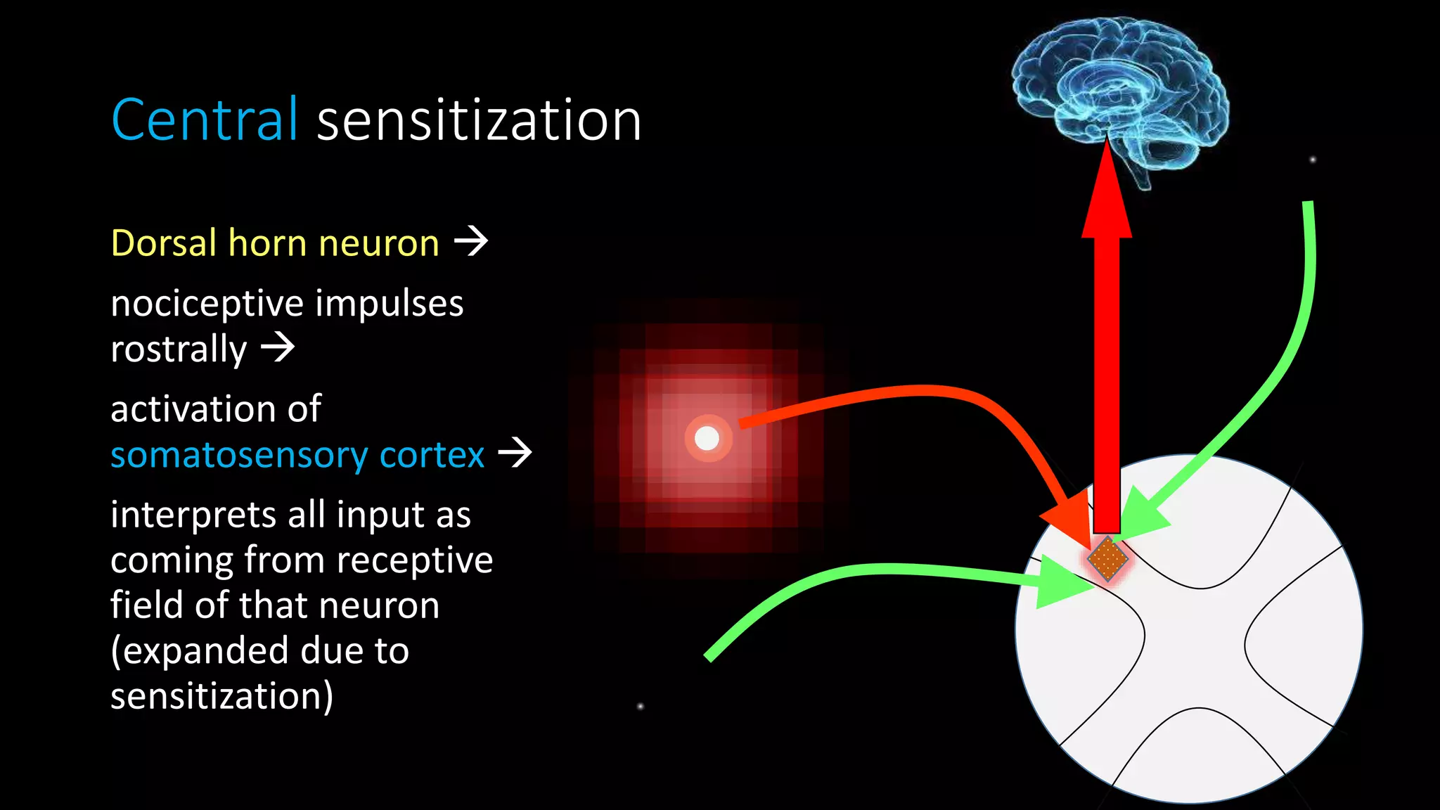Central sensitization
Dorsal horn neuron 
nociceptive impulses
rostrally 
activation of
somatosensory cortex 
interprets all input as
coming from receptive
field of that neuron
(expanded due to
sensitization)
 