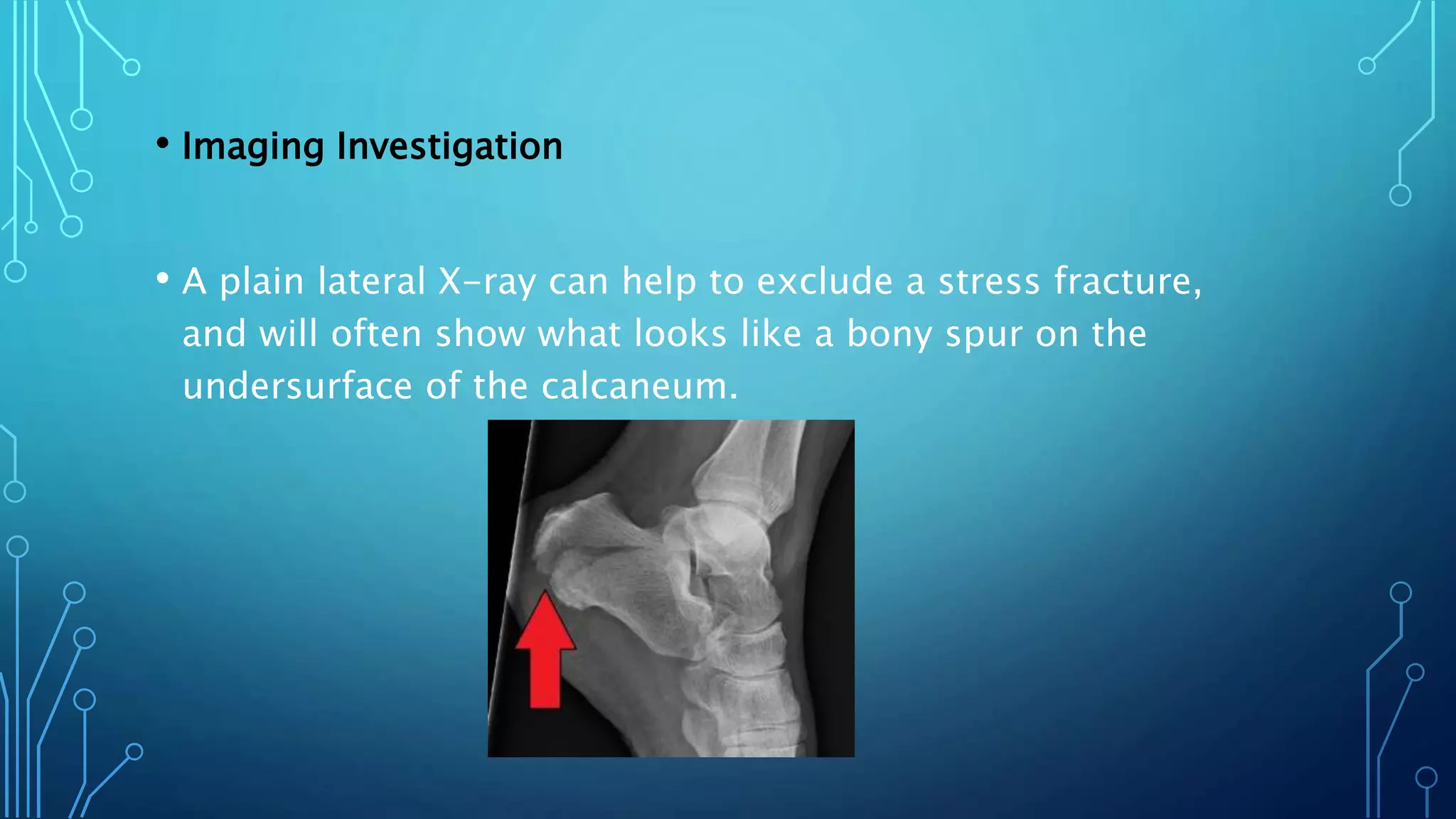• Imaging Investigation
• A plain lateral X-ray can help to exclude a stress fracture,
and will often show what looks like a bony spur on the
undersurface of the calcaneum.
 