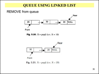 QUEUE USING LINKED LIST
REMOVE from queue
35
 