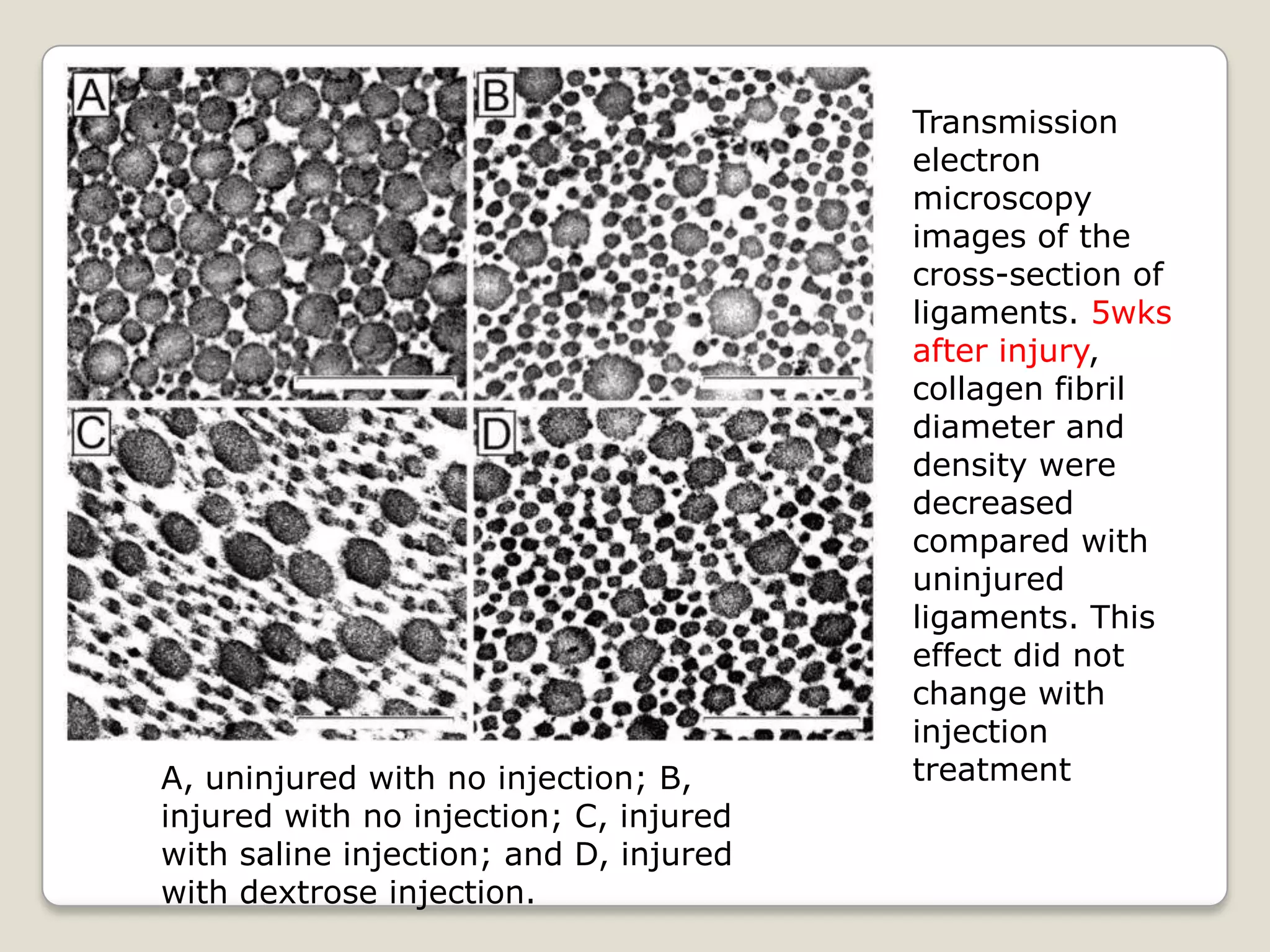 Transmission electron microscopy images of the cross-section of ligaments. 5wks after injury, collagen fibril diameter and density were decreased compared with uninjured ligaments. This effect did not change with injection treatment A, uninjured with no injection; B, injured with no injection; C, injured with saline injection; and D, injured with dextrose injection.