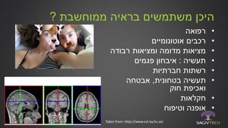 ‫ממוחשבת‬ ‫בראיה‬ ‫משתמשים‬ ‫היכן‬?
•‫רפואה‬
•‫אוטונומיים‬ ‫רכבים‬
•‫רבודה‬ ‫ומציאות‬ ‫מדומה‬ ‫מציאות‬
•‫תעשיה‬:‫פגמים‬ ‫איבחון‬
•‫חברתיות‬ ‫רשתות‬
•‫בטחונית‬ ‫תעשיה‬,‫אבטחה‬
‫ואכיפת‬‫חוק‬
•‫חקלאות‬
•‫וטיפוח‬ ‫אופנה‬
Taken from: http://www.cvl.isy.liu.se/
 