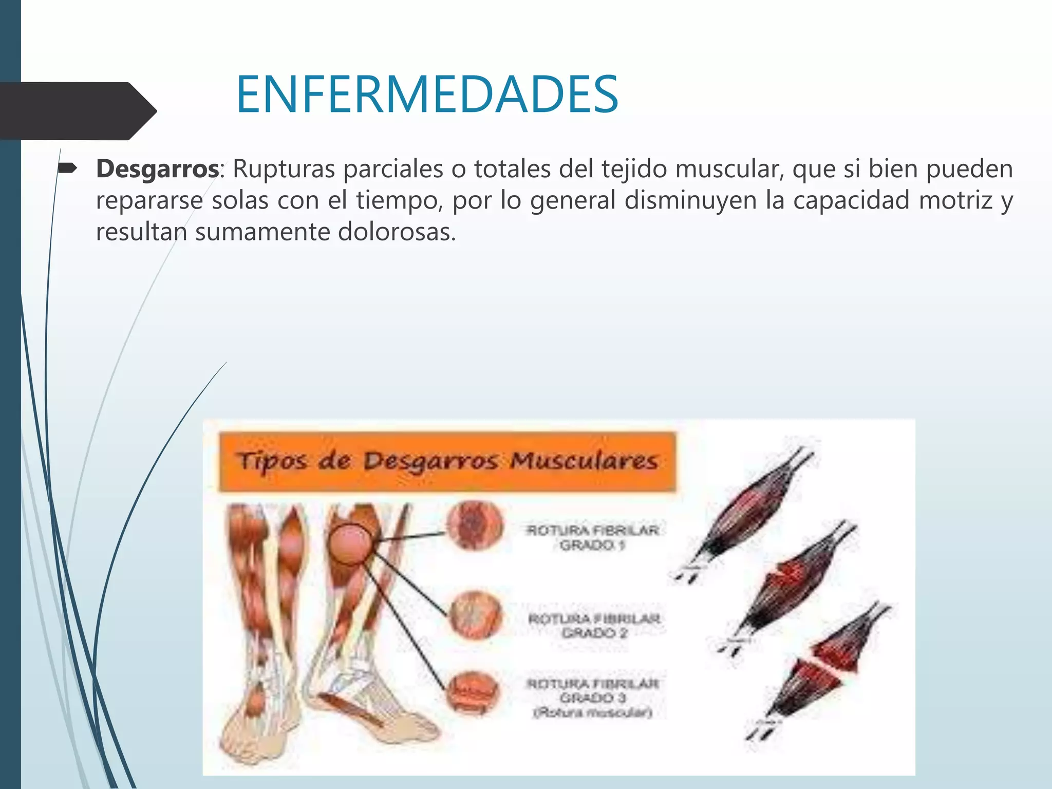 ENFERMEDADES
 Desgarros: Rupturas parciales o totales del tejido muscular, que si bien pueden
repararse solas con el tiempo, por lo general disminuyen la capacidad motriz y
resultan sumamente dolorosas.
 