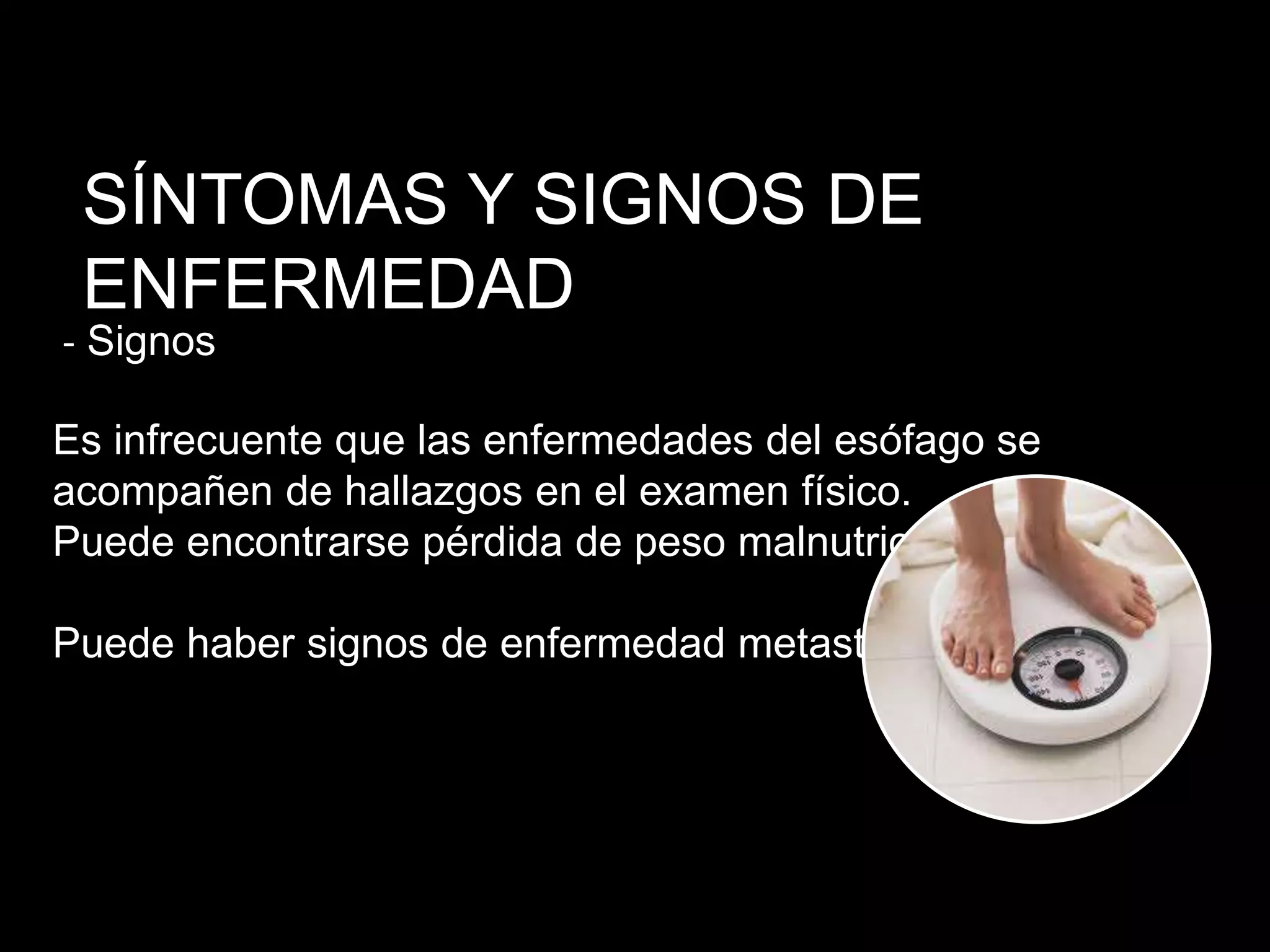 SÍNTOMAS Y SIGNOS DE
ENFERMEDAD
‐ Signos
Es infrecuente que las enfermedades del esófago se
acompañen de hallazgos en el examen físico.
Puede encontrarse pérdida de peso malnutrición.
Puede haber signos de enfermedad metastásica.
 