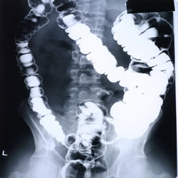colon_250x251