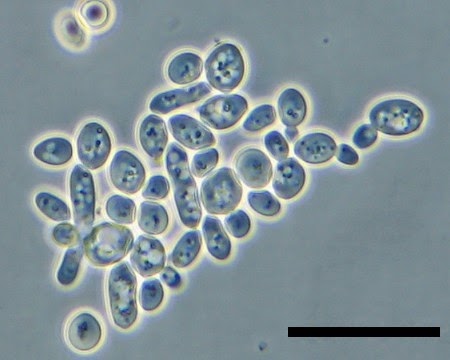 Microscope World Blog: Kids Science Microscope Activity: Yeast