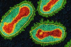 smallpox