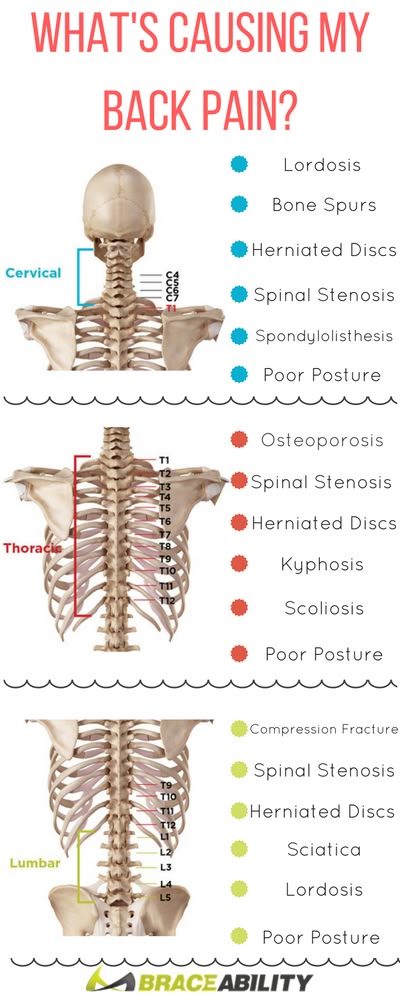 What's causing your back pain? Learn about the many lower, middle, & upper back conditions that can occur to your spine & cause you discomfort. | BraceAbility: