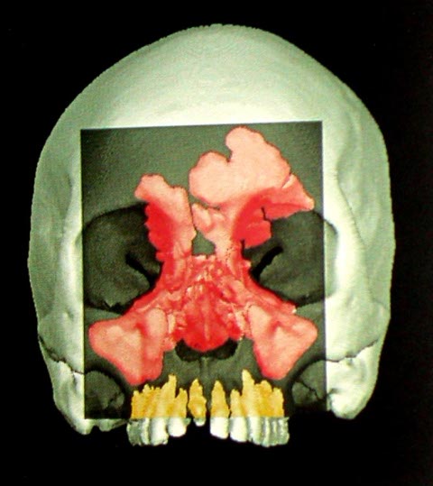 human-sinuses human-sinuses