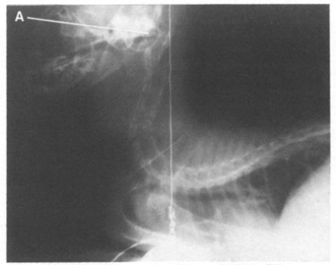 VidalEtAl1986-fig2-cat VidalEtAl1986-fig2-cat