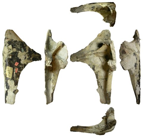 cervical-rib-x1-composite