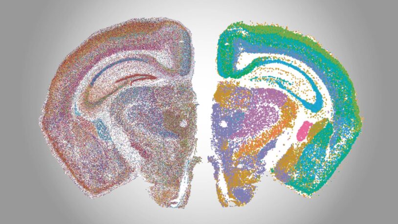 Colorful, dotted maps of two brain cross-sections displayed side by side on a light gradient background.